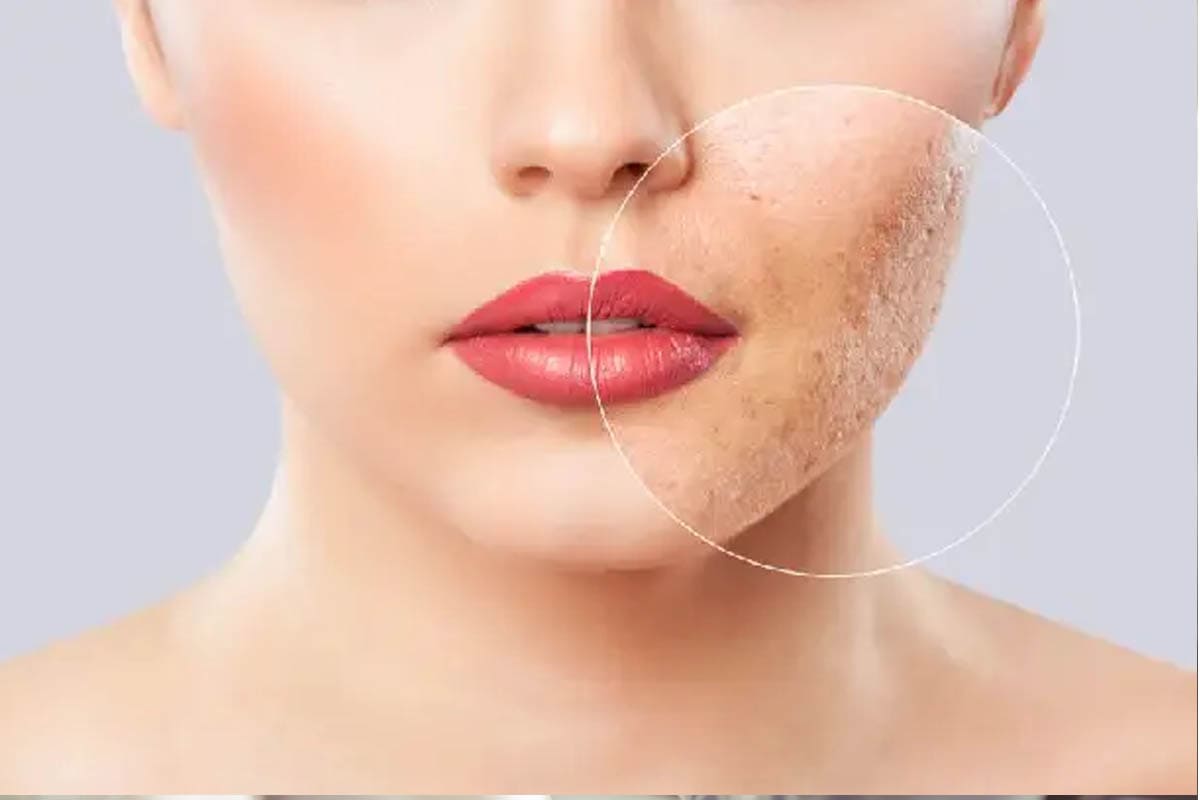 Dermatology
